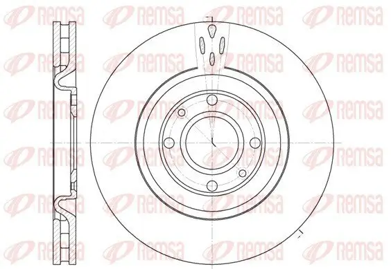 Bremsscheibe Vorderachse REMSA 6590.10