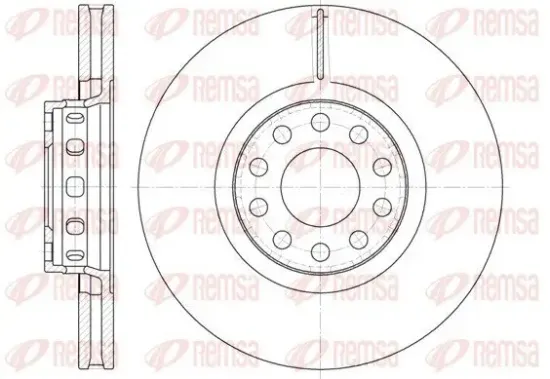 Bremsscheibe Vorderachse REMSA 6592.10 Bild Bremsscheibe Vorderachse REMSA 6592.10