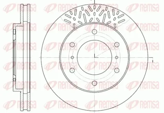 Bremsscheibe Vorderachse REMSA 6639.10 Bild Bremsscheibe Vorderachse REMSA 6639.10
