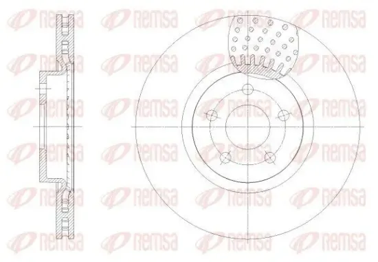 Bremsscheibe Vorderachse REMSA 62549.10 Bild Bremsscheibe Vorderachse REMSA 62549.10