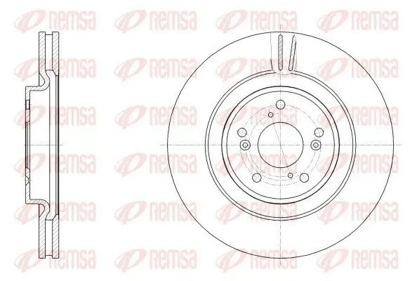 Bremsscheibe Vorderachse REMSA 62557.10
