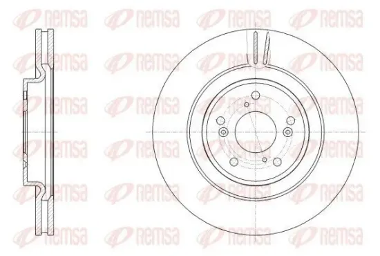 Bremsscheibe Vorderachse REMSA 62557.10 Bild Bremsscheibe Vorderachse REMSA 62557.10