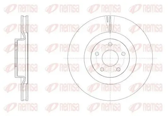 Bremsscheibe Vorderachse REMSA 62558.10 Bild Bremsscheibe Vorderachse REMSA 62558.10