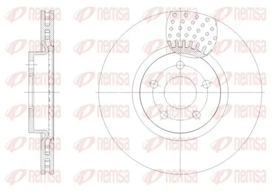 Bremsscheibe Vorderachse REMSA 62549.10 Bild Bremsscheibe Vorderachse REMSA 62549.10