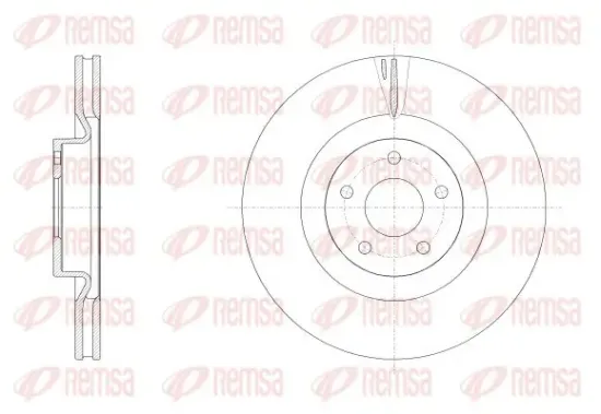 Bremsscheibe Vorderachse REMSA 62558.10 Bild Bremsscheibe Vorderachse REMSA 62558.10
