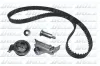 Zahnriemensatz DOLZ SKD110