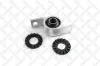 Lagerung, Lenker unten links STELLOX 87-17016-SX Bild Lagerung, Lenker unten links STELLOX 87-17016-SX