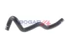 Kühlerschlauch BOGAP A4228362 Bild Kühlerschlauch BOGAP A4228362