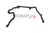 Kühlerschlauch BOGAP B4228429 Bild Kühlerschlauch BOGAP B4228429