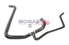 Kühlerschlauch BOGAP E4228185 Bild Kühlerschlauch BOGAP E4228185