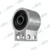 Lagerung, Lenker Vorderachse unten hinten ALTE AUTOMOTIVE 88857AL